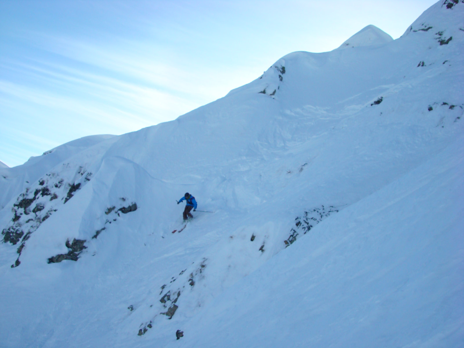 Верхняя часть FWT